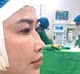 Slider image (7) Dr. Nhan Ho Aesthetics and Plastic Surgery